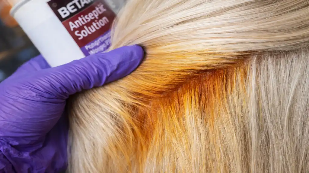 Reflets jaunes et orangés sur cheveux blonds après contact avec la bétadine povidone iodée